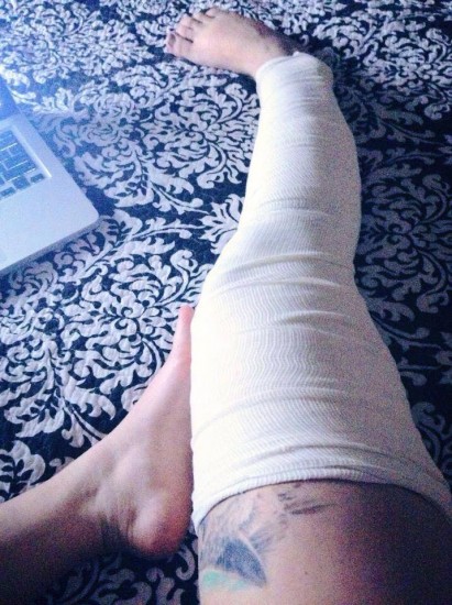 Accidente de bicicleta.