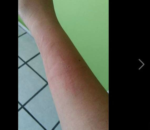Agresión a una mujer en Zapopan.