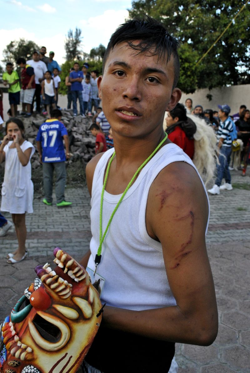 Las heridas con motivo de orgullo para los jovenes tastoanes. Foto: Miriam Jiménez.